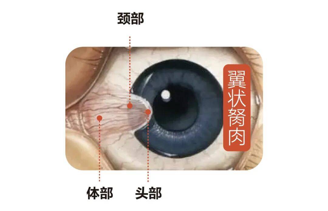 文章配图-2